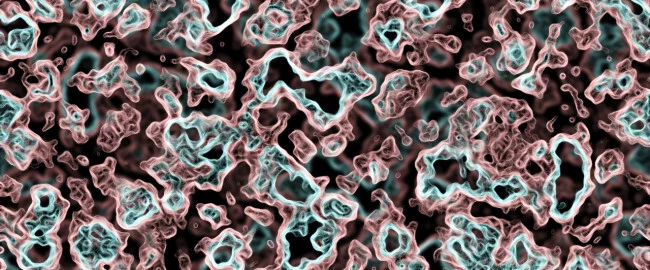 Toksoplazmoza w ciąży? Spokojnie…