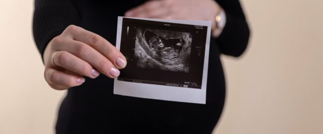 Różyczka w ciąży. Jak można jej uniknąć i co trzeba wiedzieć?